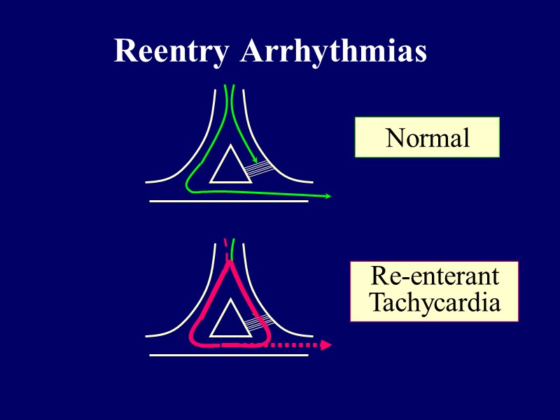 Reentry Arrhythmias Normal Re-enterant Tachycardia